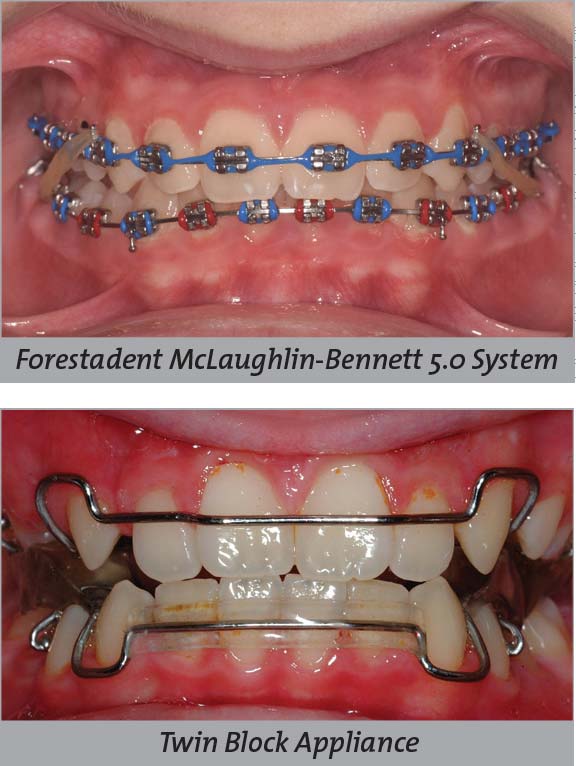 Day 4 Seminars Global Leader In Orthodontics - 